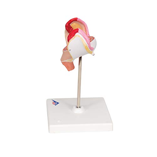 Image of 3B Scientific L10 /1 1st Month Embryo - 3B Smart Anatomy