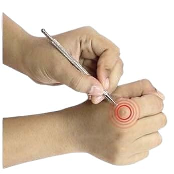 Image of acupressure Acupuncture six ki auricular full therapy Combo kit