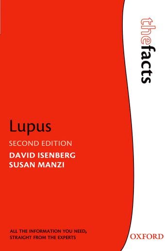 Buy Lupus (The Facts) — BookShops.in