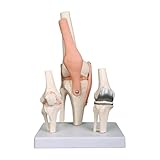 Generic Life Size Knee Joint Anatomy Model Set, Educational Medical Training Display with Osteoarthritic Stage, Implant Demonstration, 3-Piece Professional Healthcare Teaching Tool