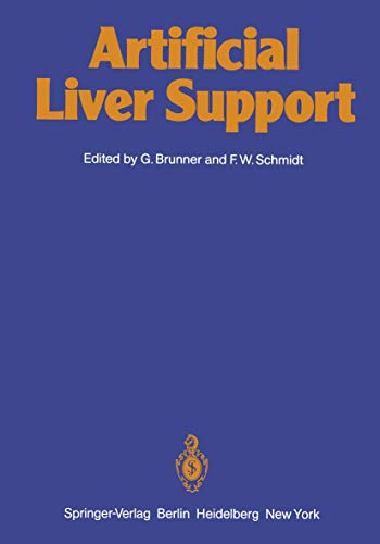 Artificial Liver Support view 2
