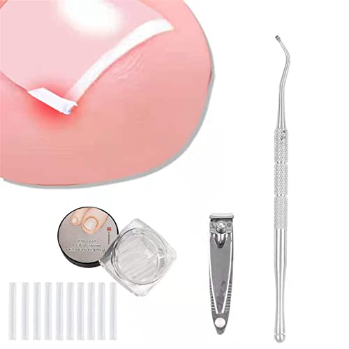 (60+2) Pack Professionelles Kit zur Korrektur von eingewachsenen Zehennägeln, 60 Stück Glätteisen für eingewachsene Zehennägel, mit 2 Feile und Heber für eingewachsene Zehennägel Cover