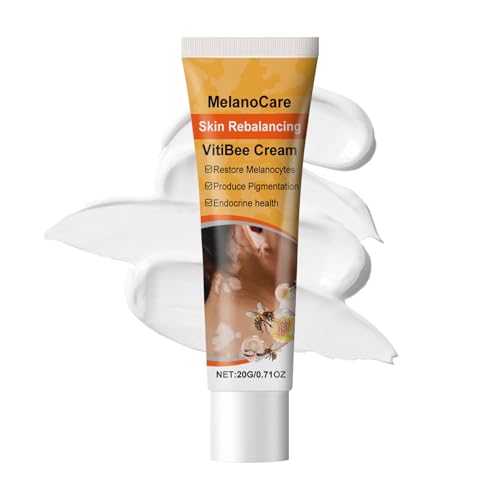 Crema Para El Cuidado De La Piel, Piel De Crema De Mancha Blanca, 20 G De La Crema De Extracción De Manchas, Objetivos De Manchas Blancas Y Imperfecciones, Fórmula De Iluminación De La Para Mujer