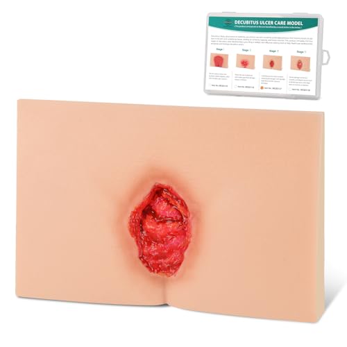 Image of Decubitus Ulcer Care Model, Bedsores Model, Pressure Injury Model for Medical Training Practice, Stage 3