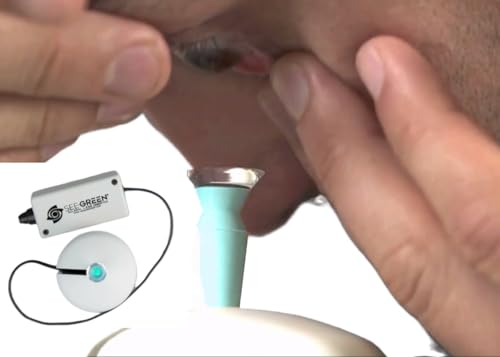 Image of See-Green FDA-Registered Scleral Lens Inserter and Remover with Light Guidance - Hands-Free (with Stand), Bubble-Free, System for Easy, Accurate, Hygienic Lens Application