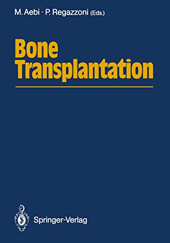 Bone Transplantation view 2