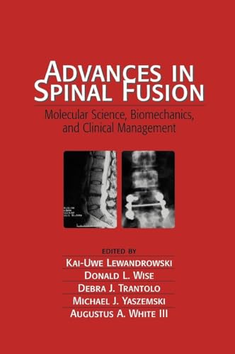 Advances in Spinal Fusion: Molecular Science, BioMechanics, and Clinical Management