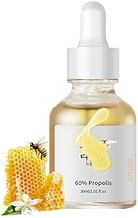 Face Glow Serum for Acne with Propolis and Niacinamide, Korean Skin Care Serum For All Skin Types