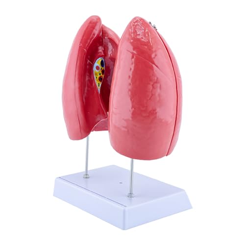 Modèle d'anatomie pulmonaire normale et structure du poumon humain - 4