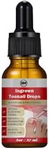 Ingrown Toenail Softening and Care Drops, Nail Softener, Foot Care Solution, Cleansing and Soothing Formula, 50ml (1, 50, millilitre)