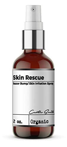 Xotics Skin Rescue Razor Bump (2oz) - Skin Irritation Spray, All Natural Barber Aftershave Razor Burn Treatment for Men/Women - Anti Itch Spray for Tattoo Aftercare, Calm Down Razor Bumps