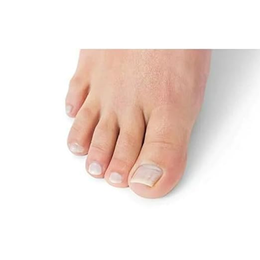 Miniatura 4 de Tratamiento Natural para Uñas Oriundo.  Tratamiento Natural para unas.