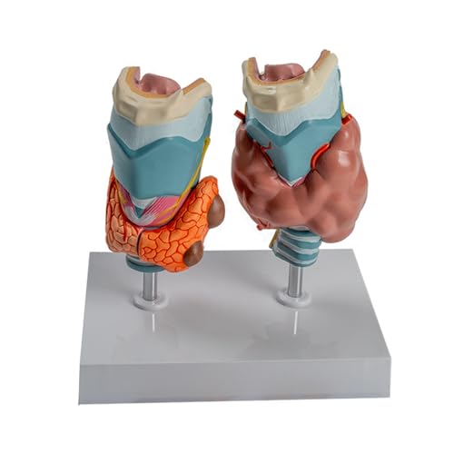 Modelo de anatomía patológica de tiroides Humana for Estudiantes de Medicina. Modelo de tiroides patológico anatómico. Enseñanza en el Aula, Material didáctico. Modelo de Garganta tiroidea patológica