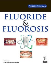 FLUORIDE & FLUOROSIS