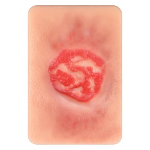 Image of Pressure Ulcer Wound Model Stage 3 Pocket Size