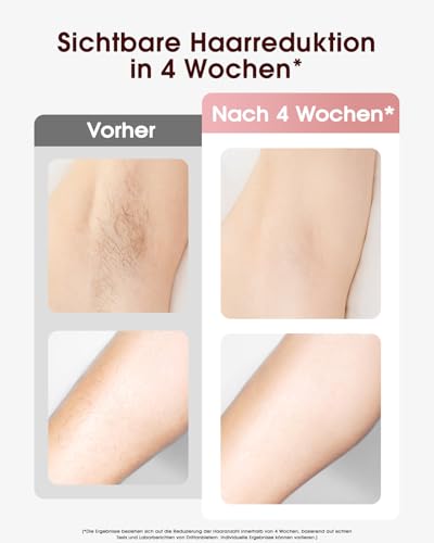 Haarlosy IPL Geräte Haarentfernung mit Kühlfunktion, 999,900 Lichtimpulse, 5 Energiestufen Schmerzfreie IPL Haarentfernung Laser Hair Removal für Frauen, Männer, Intimbereich, Körper und Beine - TD005 3