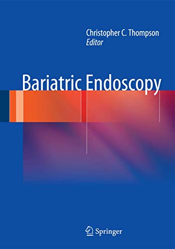 Bariatric Endoscopy view 2