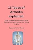  11 Types of Arthritis explained: How to Recognise Symptoms Early, Reduce Pain, and Protect Your Joints for Life (How to live with arthritis) (English Edition)