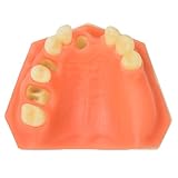 Modèle de formation à l'implant dentaire maxillaire avec sinus maxillaire, modèle de fo...