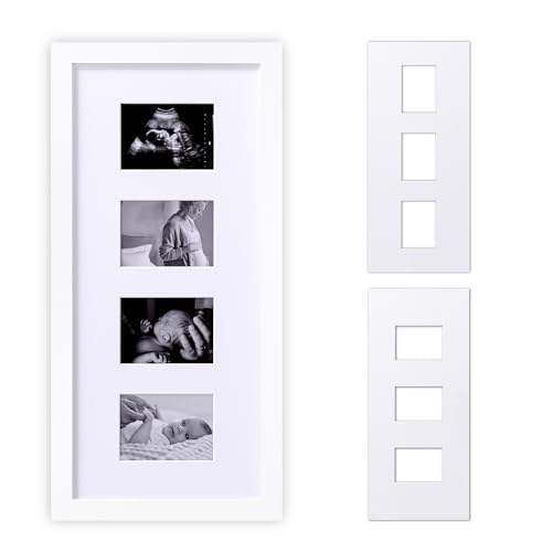 Image of eletecpro Ultrasound Picture Frame, Baby Sonogram Picture Frame Display 3 or 4 Photos, Vertical or Horizontal, Idea Gift for Expecting Parents, Pregnant, Gender Reveal Party, Baby Nursery Decor, White