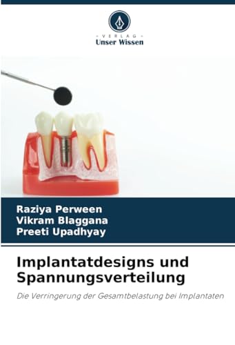 Implantatdesigns und Spannungsverteilung: Die Verringerung der Gesamtbelastung bei Implantaten