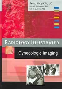Radiology Illustrated: Gynecologic Imaging