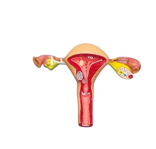 LabHouse Uterus And Ovary Model Female Reproductive Organ Model Teaching Anatomical Gynecology Doctor (B0D86KWRRJ) Amazon Price History, Amazon Price Tracker