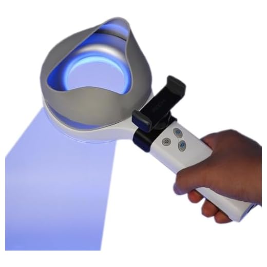Professional Woods Lamp Skin Analyzer