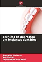 Técnicas de impressão em implantes dentários (Portuguese Edition) 3841639925 Book Cover
