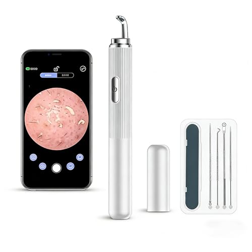 50x HD Visual Blackhead Remover with Camera for Phone - Manual Pimple Extractor Tool with LED Light & USB-C Rechargeable Comedone Extractor for Face Nose – Clear Skin Care Kit (White)