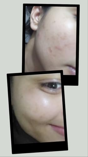 Image of Oily & Acne Prone Face Wash