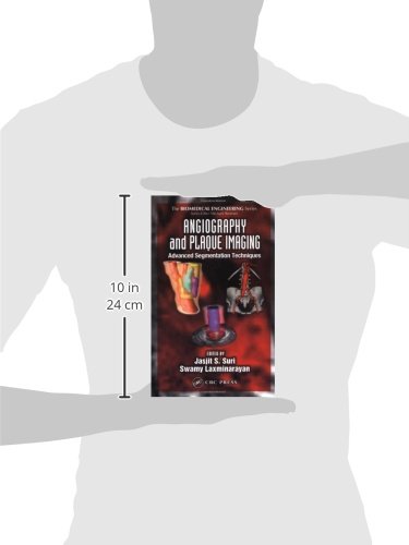 Angiography and Plaque Imaging: Advanced Segmentation Techniques (Biomedical Engineering)