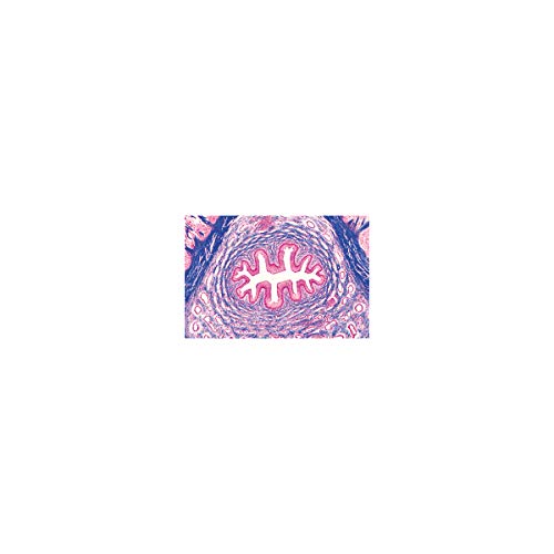 Image of 3B Scientific GmbH W13315 Urinary System-German