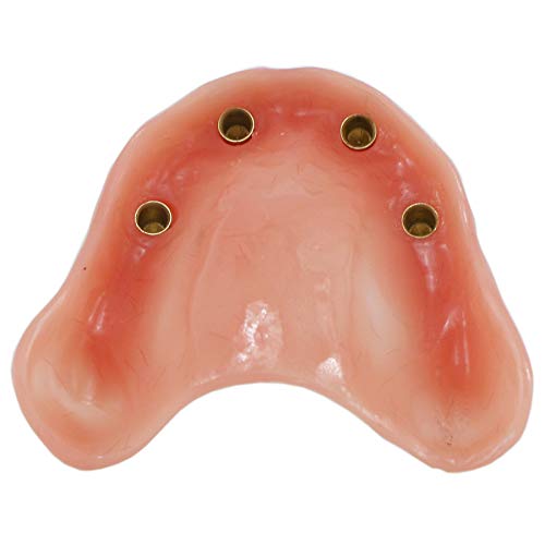 Dentalmall Dental Upper Implants Model Overdenture With 4 Superior Teeth Demo Transparent Vision For Education And Study Model Tool M6001 C #TOP3