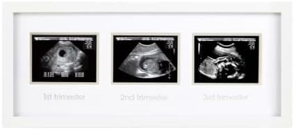 Pearhead Sonogram Progression Frame, Pregnancy Milestone Keepsake for 1st 2nd & 3rd Trimester Ultrasound Photos, Gender-Neutral Nursery Décor, White