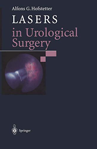 Springer - Lasers in Urological Surgery - -24%