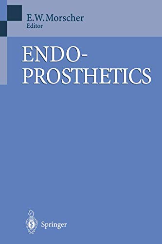 Endoprosthetics view 2