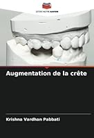 Augmentation de la crête 6205315025 Book Cover