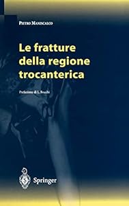 Le fratture della regione trocanterica