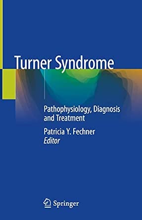 Turner Syndrome: Pathophysiology, Diagnosis and Treatment 1st ed. 2020 Edition-Wow! eBook