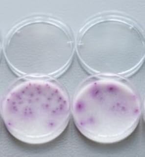 10Pcs 35mm Chromogenic Medium Plates Culture Plates Petri Dish Agar Plate for Precise Microbial Analysis (Salmonella)