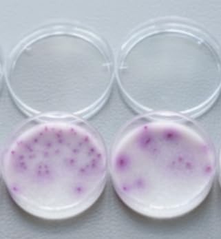WEEGEEKS 10Pcs 35mm Chromogenic Medium Plates Culture Plates Petri Dish Agar Plate for Precise Microbial Analysis (Salmonella)