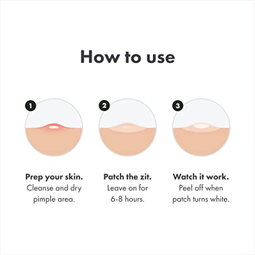 Mighty Patch Original From Hero Cosmetics - Hydrocolloid Acne Pimple Patch For Covering Zits And Blemishes, Spot Stickers For Face And Skin, Vegan-Friendly And Not Tested On Animals (72 Count) #TOP5