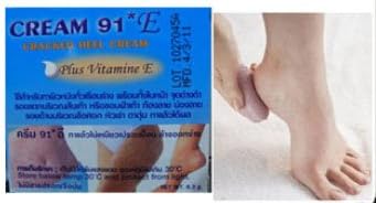 Cream 91 E for Cracked Heels Plus Vitamin E Stretchmarks Dark Spots Knees Elbows