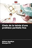 Choix de la teinte d'une prothèse partielle fixe 6205303663 Book Cover