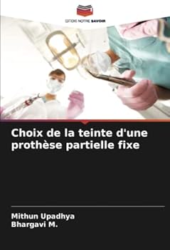 Paperback Choix de la teinte d'une prothèse partielle fixe [French] Book