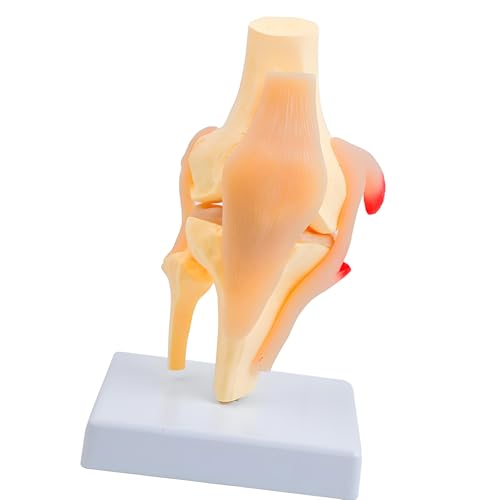 Modelo de rodilla anatómico profesional con rótula y ligamentos musculares
