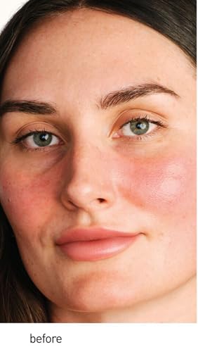 Image of Erborian CC Red Color Correcting SPF 25 Green Pigment Cream, Neutralizes Redness, Calms Skin, Lightweight, Tone‑Perfecting Primer, Korean Skincare