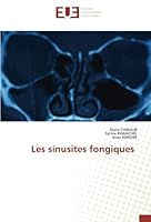 Les sinusites fongiques 6203442461 Book Cover