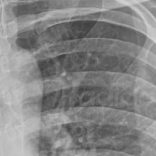 Something about Souls and Zebras